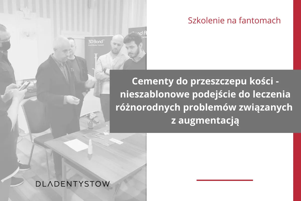 Cementy do przeszczepu kości - nieszablonowe podejście do leczenia różnorodnych problemów związanych z augmentacją