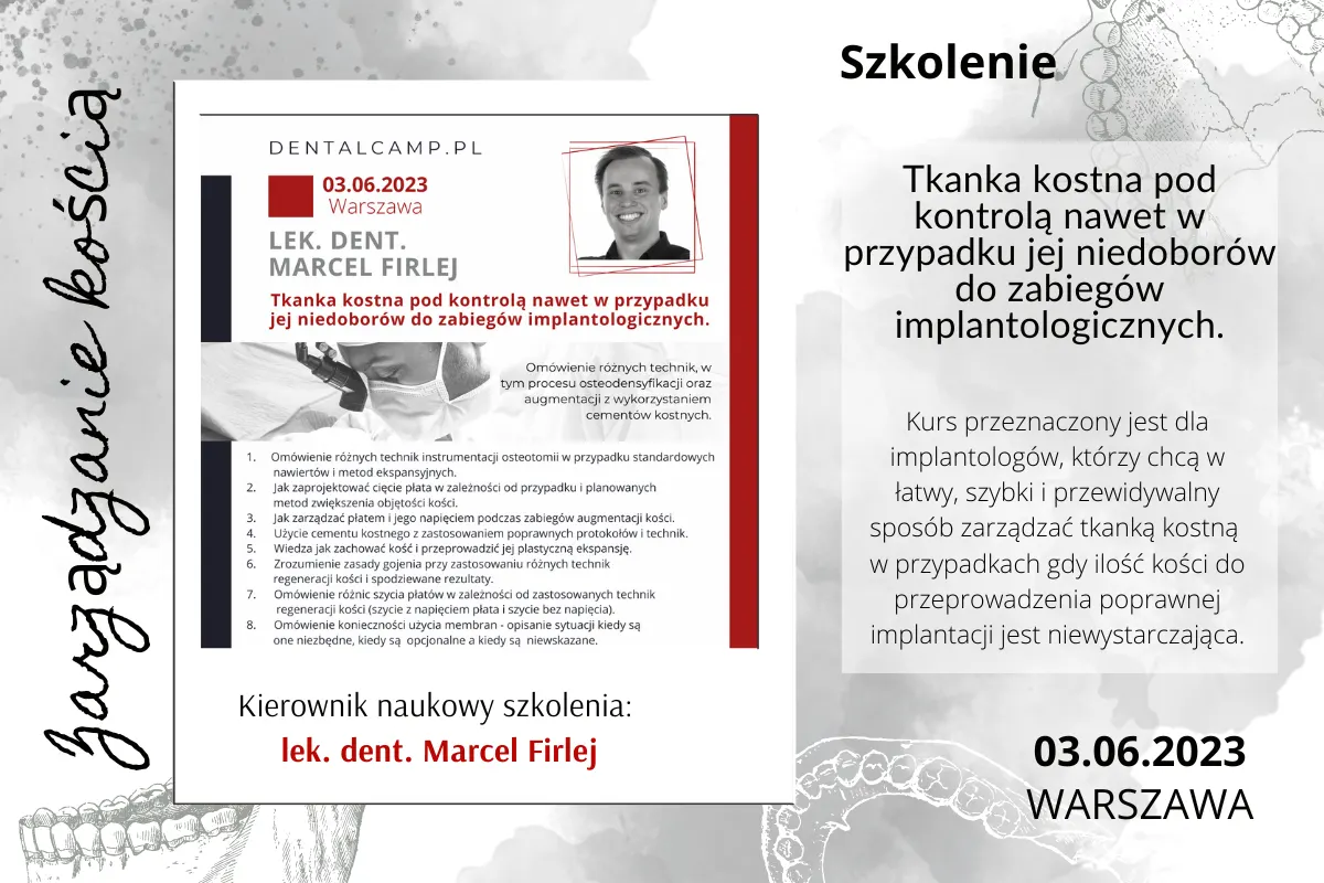 Tkanka kostna pod kontrolą nawet w przypadku jej niedoborów do zabiegów implantologicznych.