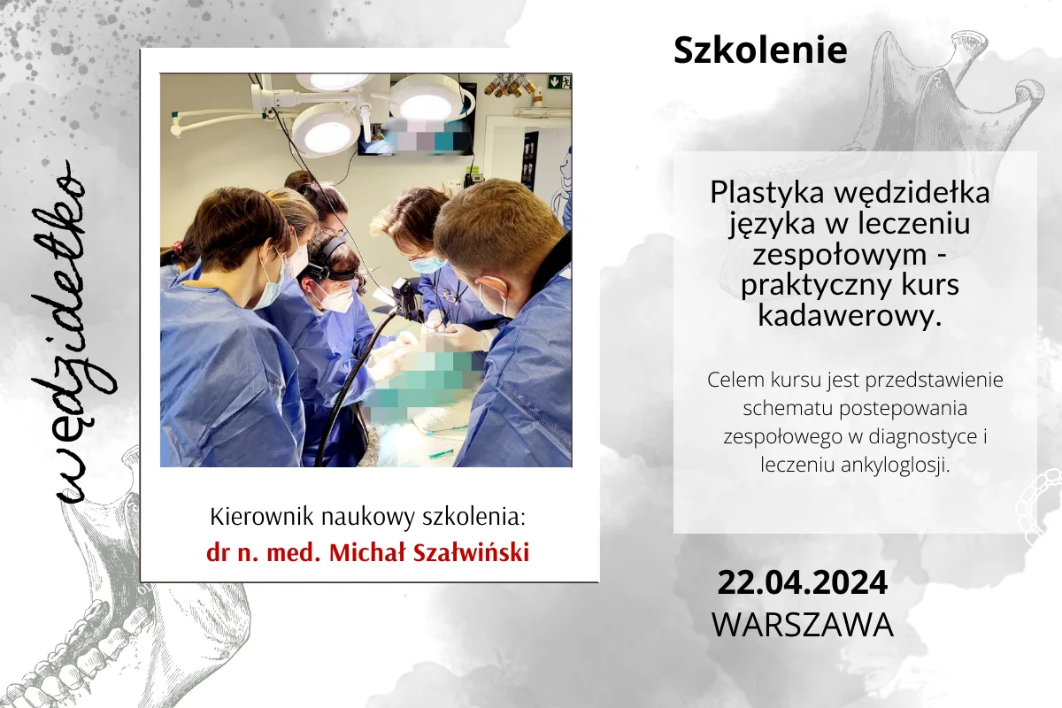 Plastyka wędzidełka języka w leczeniu zespołowym - praktyczny kurs kadawerowy